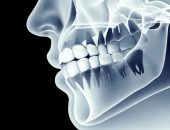 Рентген зуба: для чего это нужно?