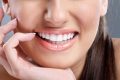 Миниатюра к статье Как улучшить свои зубы